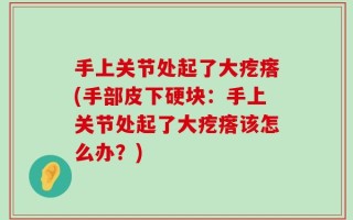 手上关节处起了大疙瘩(手部皮下硬块：手上关节处起了大疙瘩该怎么办？)