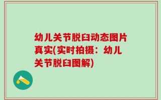 幼儿关节脱臼动态图片真实(实时拍摄：幼儿关节脱臼图解)