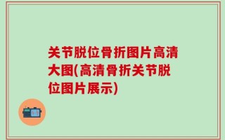 关节脱位骨折图片高清大图(高清骨折关节脱位图片展示)
