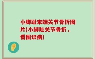 小脚趾末端关节骨折图片(小脚趾关节骨折，看图识病)