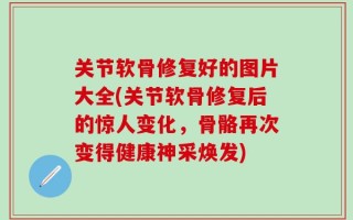 关节软骨修复好的图片大全(关节软骨修复后的惊人变化，骨骼再次变得健康神采焕发)