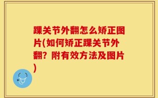 踝关节外翻怎么矫正图片(如何矫正踝关节外翻？附有效方法及图片)