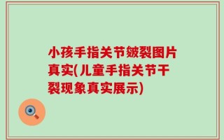 小孩手指关节皴裂图片真实(儿童手指关节干裂现象真实展示)