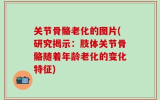 关节骨骼老化的图片(研究揭示：肢体关节骨骼随着年龄老化的变化特征)
