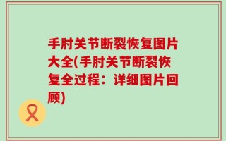 手肘关节断裂恢复图片大全(手肘关节断裂恢复全过程：详细图片回顾)