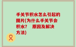 手关节积水怎么引起的图片(为什么手关节会积水？  原因及解决方法)