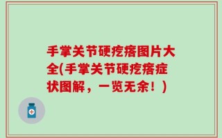 手掌关节硬疙瘩图片大全(手掌关节硬疙瘩症状图解，一览无余！)