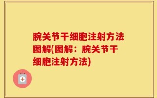 腕关节干细胞注射方法图解(图解：腕关节干细胞注射方法)