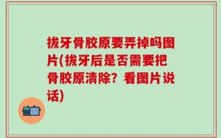 拔牙骨胶原要弄掉吗图片(拔牙后是否需要把骨胶原清除？看图片说话)