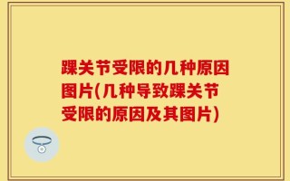踝关节受限的几种原因图片(几种导致踝关节受限的原因及其图片)