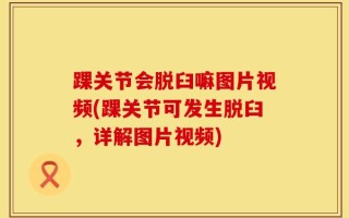 踝关节会脱臼嘛图片视频(踝关节可发生脱臼，详解图片视频)