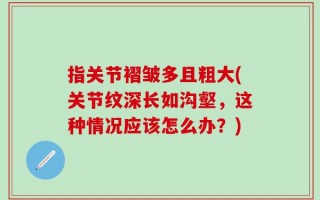 指关节褶皱多且粗大(关节纹深长如沟壑，这种情况应该怎么办？)