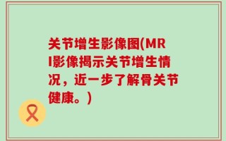 关节增生影像图(MRI影像揭示关节增生情况，近一步了解骨关节健康。)
