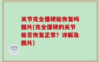 关节完全僵硬能恢复吗图片(完全僵硬的关节能否恢复正常？详解及图片)