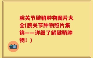腕关节腱鞘肿物图片大全(腕关节肿物照片集锦——详细了解腱鞘肿物！)