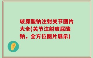 玻尿酸钠注射关节图片大全(关节注射玻尿酸钠，全方位图片展示)