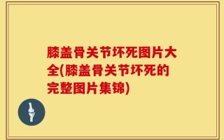 膝盖骨关节坏死图片大全(膝盖骨关节坏死的完整图片集锦)