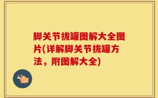脚关节拔罐图解大全图片(详解脚关节拔罐方法，附图解大全)