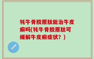 牦牛骨胶原肽能治牛皮癣吗(牦牛骨胶原肽可缓解牛皮癣症状？)
