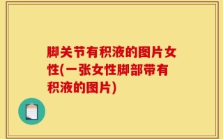 脚关节有积液的图片女性(一张女性脚部带有积液的图片)