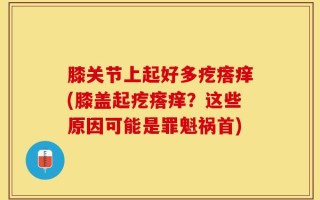 膝关节上起好多疙瘩痒(膝盖起疙瘩痒？这些原因可能是罪魁祸首)