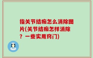 指关节结痂怎么消除图片(关节结痂怎样消除？一些实用窍门)