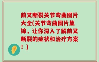 前叉断裂关节弯曲图片大全(关节弯曲图片集锦，让你深入了解前叉断裂的症状和治疗方案！)