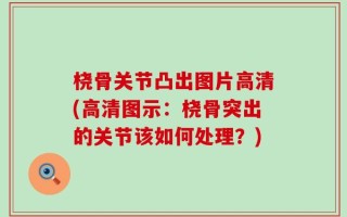 桡骨关节凸出图片高清(高清图示：桡骨突出的关节该如何处理？)