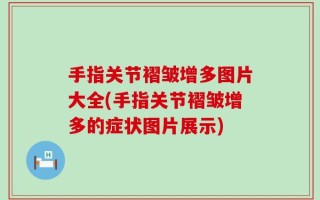 手指关节褶皱增多图片大全(手指关节褶皱增多的症状图片展示)