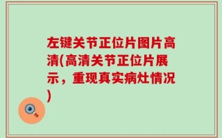 左键关节正位片图片高清(高清关节正位片展示，重现真实病灶情况)