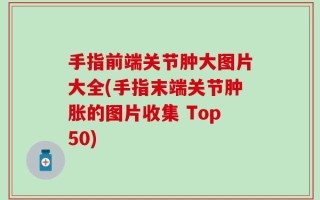 手指前端关节肿大图片大全(手指末端关节肿胀的图片收集 Top50)