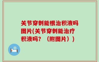 关节穿刺能根治积液吗图片(关节穿刺能治疗积液吗？（附图片）)