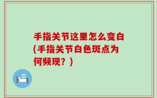 手指关节这里怎么变白(手指关节白色斑点为何频现？)