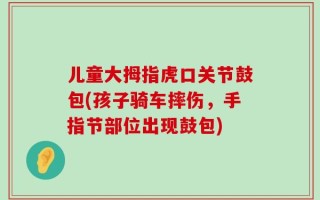 儿童大拇指虎口关节鼓包(孩子骑车摔伤，手指节部位出现鼓包)