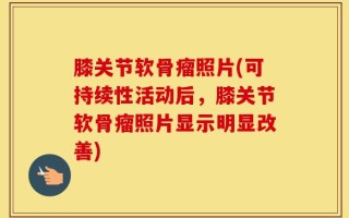 膝关节软骨瘤照片(可持续性活动后，膝关节软骨瘤照片显示明显改善)