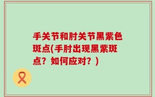 手关节和肘关节黑紫色斑点(手肘出现黑紫斑点？如何应对？)