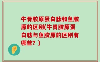 牛骨胶原蛋白肽和鱼胶原的区别(牛骨胶原蛋白肽与鱼胶原的区别有哪些？)