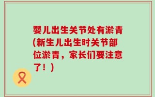 婴儿出生关节处有淤青(新生儿出生时关节部位淤青，家长们要注意了！)
