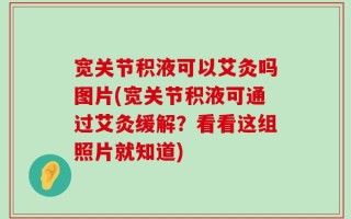 宽关节积液可以艾灸吗图片(宽关节积液可通过艾灸缓解？看看这组照片就知道)