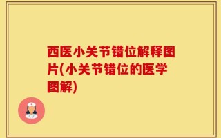 西医小关节错位解释图片(小关节错位的医学图解)