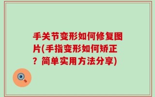 手关节变形如何修复图片(手指变形如何矫正？简单实用方法分享)