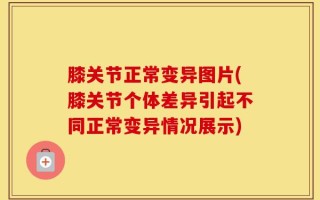 膝关节正常变异图片(膝关节个体差异引起不同正常变异情况展示)