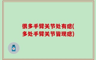 很多手臂关节处有痣(多处手臂关节皆现痣)