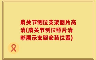 肩关节侧位支架图片高清(肩关节侧位照片清晰展示支架安装位置)