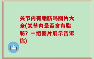 关节内有脂肪吗图片大全(关节内是否含有脂肪？一组图片展示告诉你)
