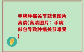手腕肿痛关节鼓包图片高清(高清图片：手腕鼓包导致肿痛关节难受)