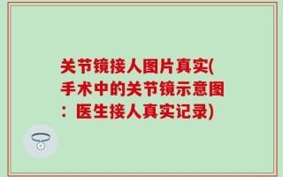 关节镜接人图片真实(手术中的关节镜示意图：医生接人真实记录)