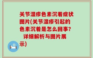 关节湿疹色素沉着症状图片(关节湿疹引起的色素沉着是怎么回事？  详细解析与图片展示)