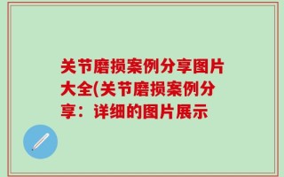 关节磨损案例分享图片大全(关节磨损案例分享：详细的图片展示