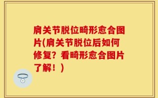 肩关节脱位畸形愈合图片(肩关节脱位后如何修复？看畸形愈合图片了解！)